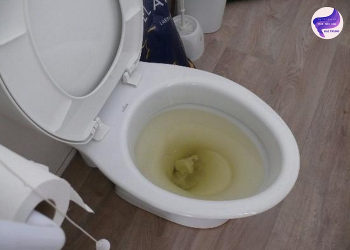 Cách thông bồn cầu tại nhà Cách thông bồn cầu tại nhà