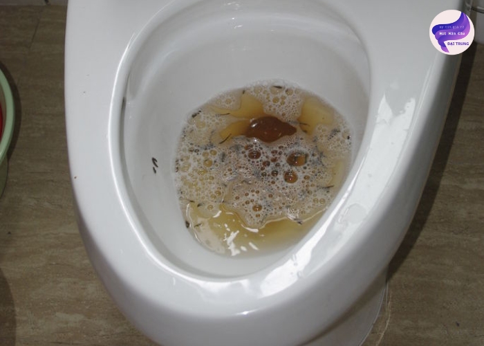 Thông bồn cầu Hà Nội (2) Thông bồn cầu Hà Nội (2)