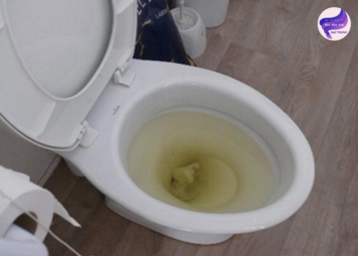 Thông tắc bồn cầu Bình Dương (2)
