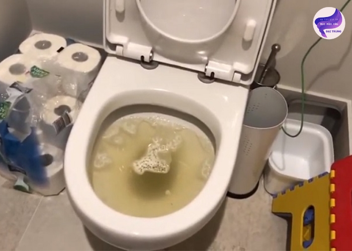 Thông bồn cầu bị nghẹt tóc